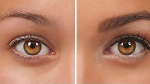 Fue yöntemi kaş ekimi